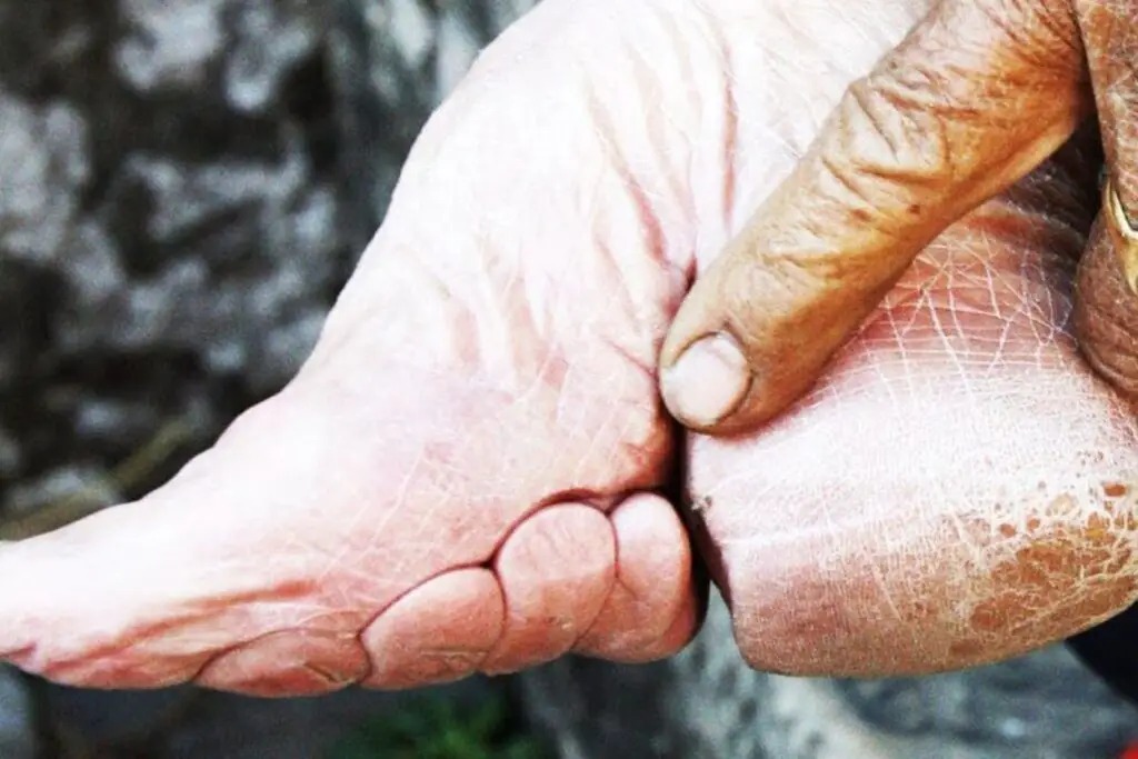 Chinese Footbinding
